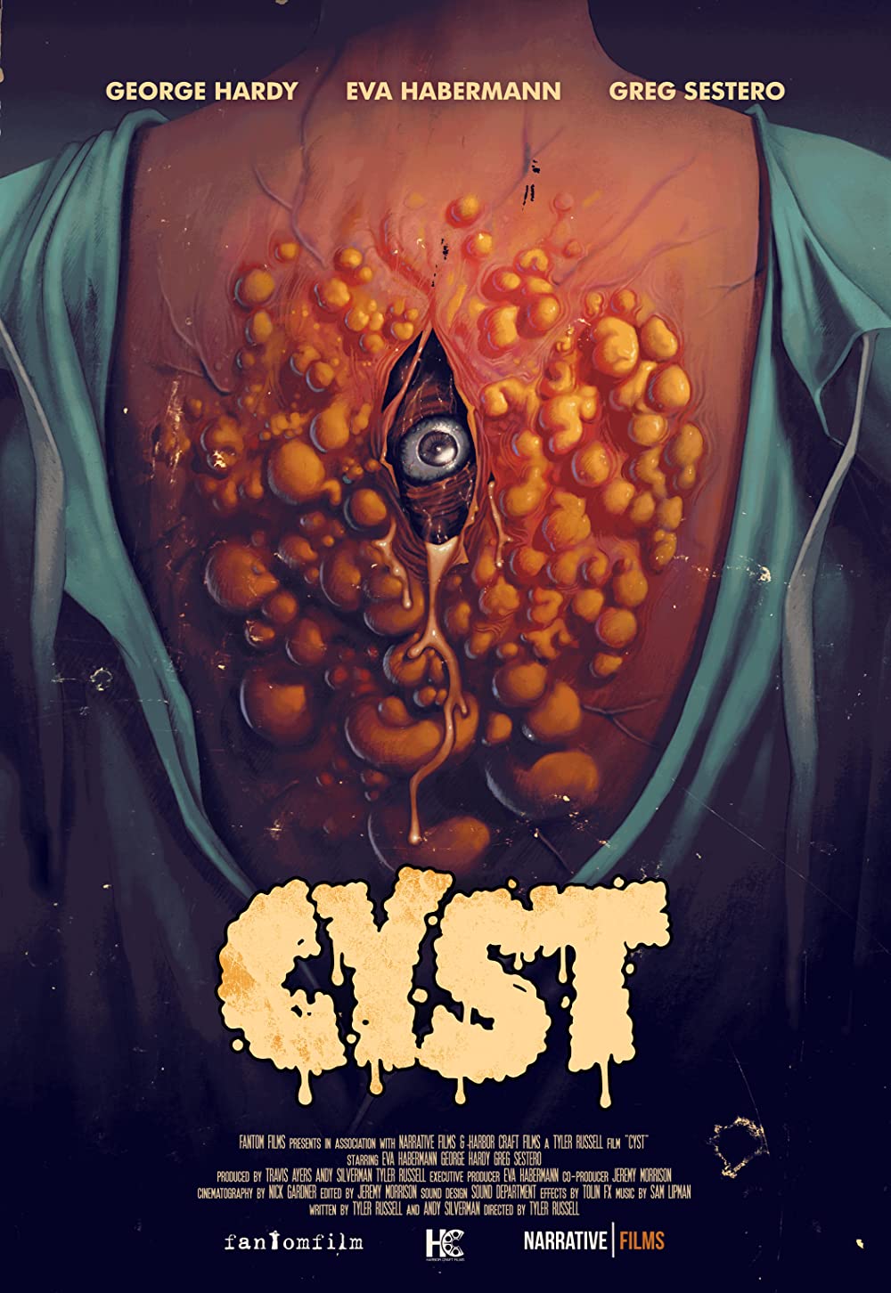 ดูหนังออนไลน์ฟรี Cyst (2020)